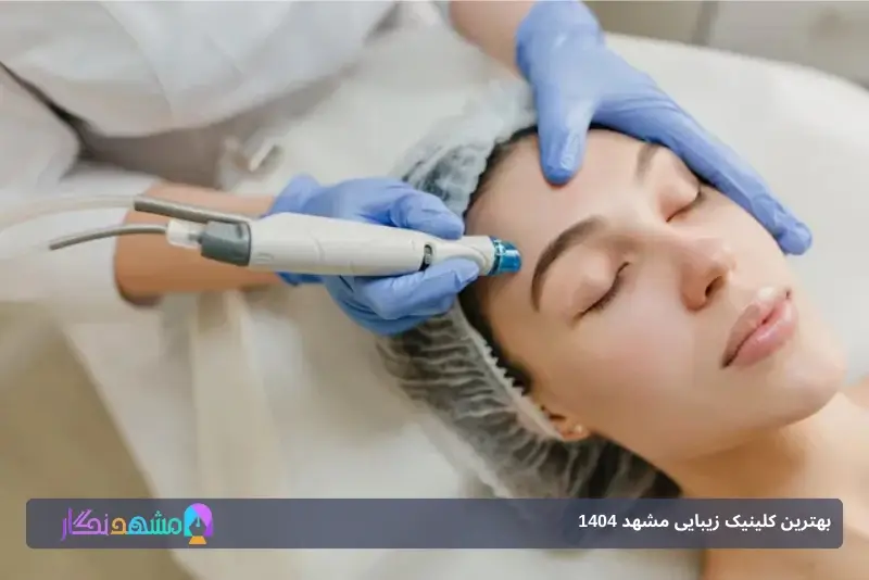 کاشت مو در مشهد